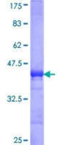 Novus Biologicals Recombinant Human p53R2 GST (N-Term) Protein 10 &mu;g | Buy Online | Novus Biologicals&trade; | Fisher Scientific