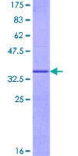 Novus Biologicals Recombinant Human G0S2 GST (N-Term) Protein 10 &mu;g | Buy Online | Novus Biologicals&trade; | Fisher Scientific