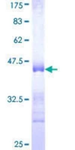 Novus Biologicals Recombinant Human Collagen V alpha 3 GST (N-Term) Protein 10 &mu;g | Buy Online | Novus Biologicals&trade; | Fisher Scientific