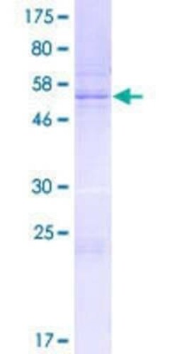 Novus Biologicals Recombinant Human SCP3/SYCP3 GST (N-Term) Protein 2 &mu;g | Buy Online | Novus Biologicals&trade; | Fisher Scientific