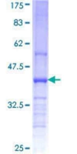Novus Biologicals Recombinant Human CHST11 GST (N-Term) Protein 25 &mu;g | Buy Online | Novus Biologicals&trade; | Fisher Scientific