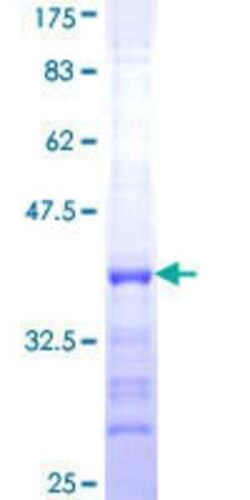 Novus Biologicals Recombinant Human UBQLN3 GST (N-Term) Protein 10 &mu;g | Buy Online | Novus Biologicals&trade; | Fisher Scientific