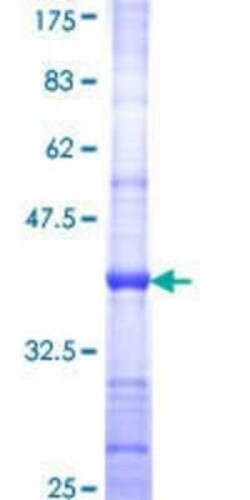 Novus Biologicals Recombinant Human GALNT9 GST (N-Term) Protein 10 &mu;g | Buy Online | Novus Biologicals&trade; | Fisher Scientific