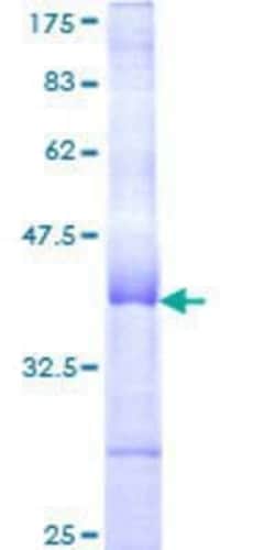 Novus Biologicals Recombinant Human CUZD1 GST (N-Term) Protein 2 &mu;g | Buy Online | Novus Biologicals&trade; | Fisher Scientific