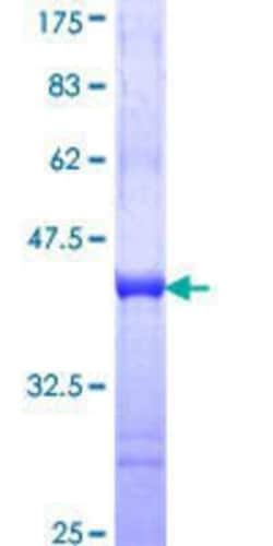 Novus Biologicals Recombinant Human Gemin 4 GST (N-Term) Protein 10 &mu;g | Buy Online | Novus Biologicals&trade; | Fisher Scientific