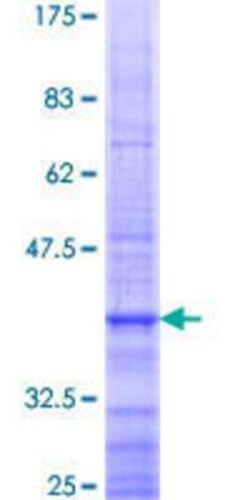 Novus Biologicals Recombinant Human ARHGEF4 GST (N-Term) Protein 25 &mu;g | Buy Online | Novus Biologicals&trade; | Fisher Scientific