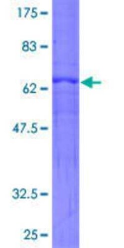 Novus Biologicals Recombinant Human ARHGEF3 GST (N-Term) Protein 10 &mu;g | Buy Online | Novus Biologicals&trade; | Fisher Scientific