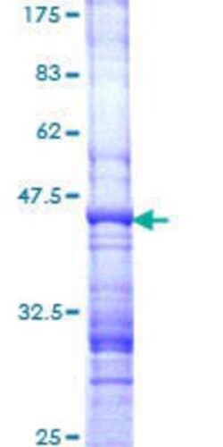 Novus Biologicals Recombinant Human ARHGEF3 GST (N-Term) Protein 10 &mu;g | Buy Online | Novus Biologicals&trade; | Fisher Scientific