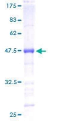 Novus Biologicals Recombinant Human Myelin expression factor 2 GST (N-Term) Protein 25 &mu;g | Buy Online | Novus Biologicals&trade; | Fisher Scientific