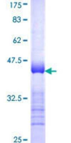 Novus Biologicals Recombinant Human ASAP1 GST (N-Term) Protein 25 &mu;g | Buy Online | Novus Biologicals&trade; | Fisher Scientific