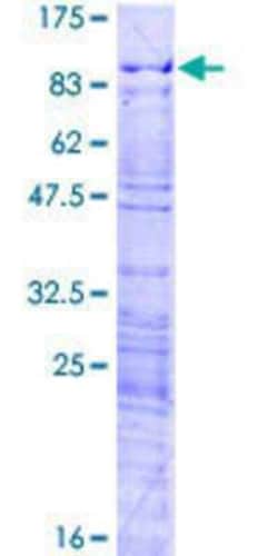 Novus Biologicals Recombinant Human HP1BP3 GST (N-Term) Protein 2 &mu;g | Buy Online | Novus Biologicals&trade; | Fisher Scientific