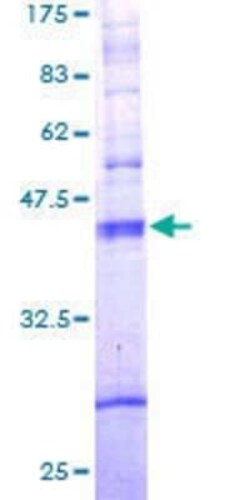 Novus Biologicals Recombinant Human TAS2R10 GST (N-Term) Protein 2 &mu;g | Buy Online | Novus Biologicals&trade; | Fisher Scientific