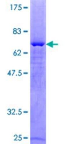 Novus Biologicals Recombinant Human PARD6A GST (N-Term) Protein 10 &mu;g | Buy Online | Novus Biologicals&trade; | Fisher Scientific