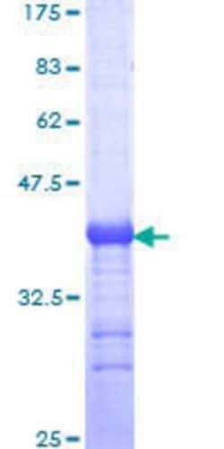 Novus Biologicals Recombinant Human PARD6A GST (N-Term) Protein 25 &mu;g | Buy Online | Novus Biologicals&trade; | Fisher Scientific