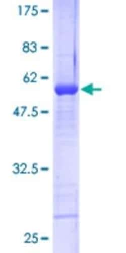 Novus Biologicals Recombinant Human RNF141 GST (N-Term) Protein 10 &mu;g | Buy Online | Novus Biologicals&trade; | Fisher Scientific