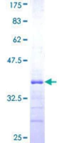 Novus Biologicals Recombinant Human RNF141 GST (N-Term) Protein 25 &mu;g | Buy Online | Novus Biologicals&trade; | Fisher Scientific