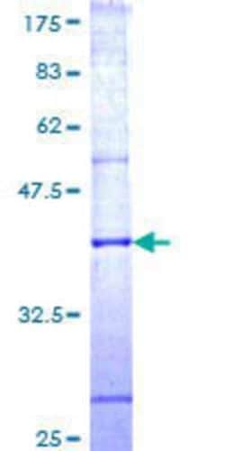 Novus Biologicals Recombinant Human Neurotrimin/HNT GST (N-Term) Protein 25 &mu;g | Buy Online | Novus Biologicals&trade; | Fisher Scientific