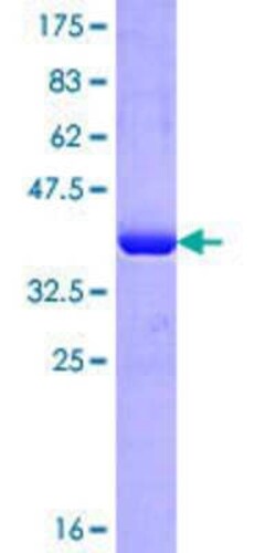 Novus Biologicals Recombinant Human IMPG2 GST (N-Term) Protein 25 &mu;g | Buy Online | Novus Biologicals&trade; | Fisher Scientific
