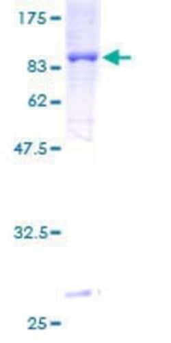 Novus Biologicals Recombinant Human TBX22 GST (N-Term) Protein 25 &mu;g | Buy Online | Novus Biologicals&trade; | Fisher Scientific