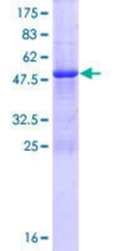Novus Biologicals Recombinant Human TMED5 GST (N-Term) Protein 10 &mu;g | Buy Online | Novus Biologicals&trade; | Fisher Scientific