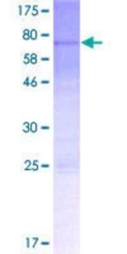 Novus Biologicals Recombinant Human MTERFD1 GST (N-Term) Protein 2 &mu;g | Buy Online | Novus Biologicals&trade; | Fisher Scientific