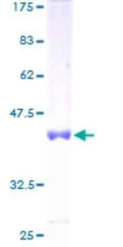 Novus Biologicals Recombinant Human MED31 GST (N-Term) Protein 10 &mu;g | Buy Online | Novus Biologicals&trade; | Fisher Scientific