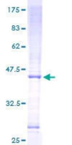 Novus Biologicals Recombinant Human MRPS16 GST (N-Term) Protein 10 &mu;g | Buy Online | Novus Biologicals&trade; | Fisher Scientific