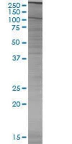 Novus Biologicals Glutaredoxin 2 293T Cell Transient Overexpression Lysate 0.1 mL | Buy Online | Novus Biologicals&trade; | Fisher Scientific