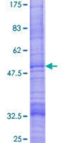 Novus Biologicals Recombinant Human golgi transport 1 homolog B GST (N-Term) Protein 25 &mu;g | Buy Online | Novus Biologicals&trade; | Fisher Scientific