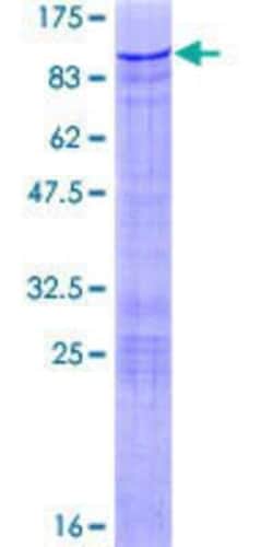 Novus Biologicals Recombinant Human Th-POK GST (N-Term) Protein 25 &mu;g | Buy Online | Novus Biologicals&trade; | Fisher Scientific