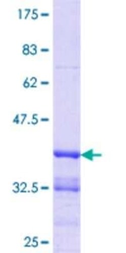 Novus Biologicals Recombinant Human Th-POK GST (N-Term) Protein 10 &mu;g | Buy Online | Novus Biologicals&trade; | Fisher Scientific