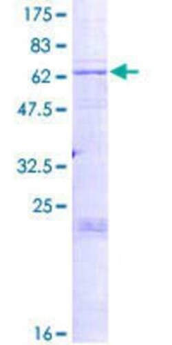 Novus Biologicals Recombinant Human ST8SIA3 GST (N-Term) Protein 2 &mu;g | Buy Online | Novus Biologicals&trade; | Fisher Scientific