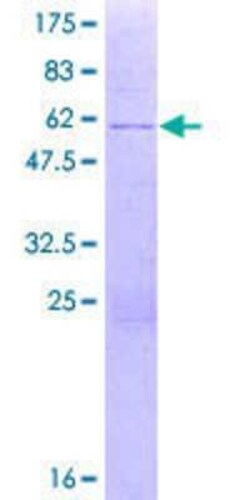 Novus Biologicals Recombinant Human ZNF691 GST (N-Term) Protein 2 &mu;g | Buy Online | Novus Biologicals&trade; | Fisher Scientific