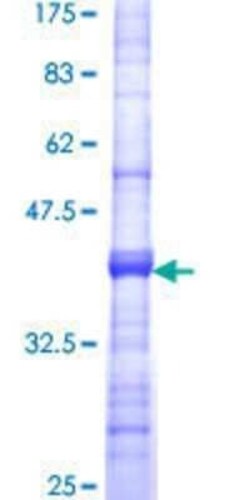 Novus Biologicals Recombinant Human SPG3A GST (N-Term) Protein 25 &mu;g | Buy Online | Novus Biologicals&trade; | Fisher Scientific