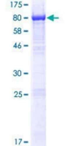 Novus Biologicals Recombinant Human NMD3 GST (N-Term) Protein 10 &mu;g | Buy Online | Novus Biologicals&trade; | Fisher Scientific