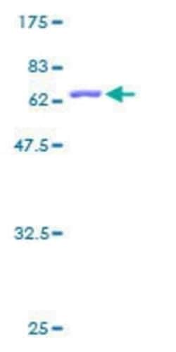 Novus Biologicals Recombinant Human mitochondrial ribosomal protein L4 GST (N-Term) Protein 2 &mu;g | Buy Online | Novus Biologicals&trade; | Fisher Scientific