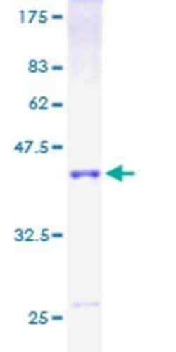 Novus Biologicals Recombinant Human GRIM19 GST (N-Term) Protein 10 &mu;g | Buy Online | Novus Biologicals&trade; | Fisher Scientific