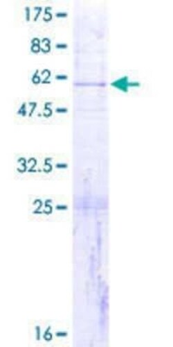 Novus Biologicals Recombinant Human MRPS7 GST (N-Term) Protein 2 &mu;g | Buy Online | Novus Biologicals&trade; | Fisher Scientific