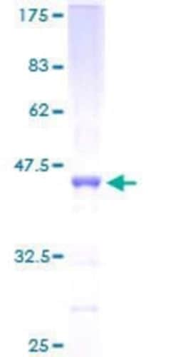 Novus Biologicals Recombinant Human POLR1D GST (N-Term) Protein 10 &mu;g | Buy Online | Novus Biologicals&trade; | Fisher Scientific