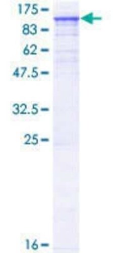 Novus Biologicals Recombinant Human TNNI3K GST (N-Term) Protein 10 &mu;g | Buy Online | Novus Biologicals&trade; | Fisher Scientific