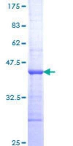 Novus Biologicals Recombinant Human TNNI3K GST (N-Term) Protein 25 &mu;g | Buy Online | Novus Biologicals&trade; | Fisher Scientific