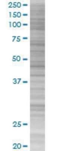 Novus Biologicals MSY2 293T Cell Transient Overexpression Lysate 0.1 mL | Buy Online | Novus Biologicals&trade; | Fisher Scientific