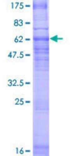 Novus Biologicals Recombinant Human AdipoR1 GST (N-Term) Protein 2 &mu;g | Buy Online | Novus Biologicals&trade; | Fisher Scientific