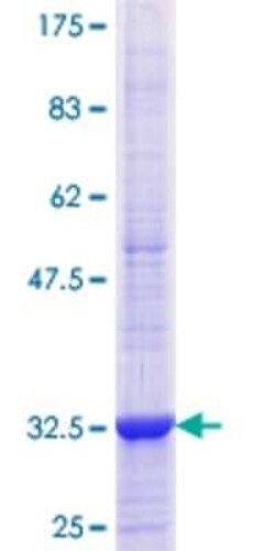 Novus Biologicals Recombinant Human AdipoR1 GST (N-Term) Protein 10 &mu;g | Buy Online | Novus Biologicals&trade; | Fisher Scientific