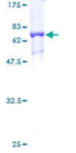 Novus Biologicals Recombinant Human TRNT1 GST (N-Term) Protein 2 &mu;g | Buy Online | Novus Biologicals&trade; | Fisher Scientific