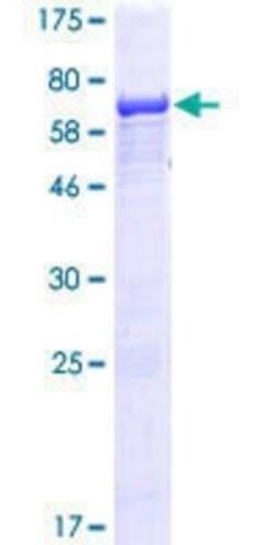 Novus Biologicals Recombinant Human IFT52 GST (N-Term) Protein 25 &mu;g | Buy Online | Novus Biologicals&trade; | Fisher Scientific