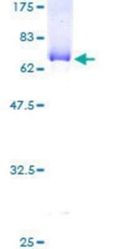 Novus Biologicals Recombinant Human Abhd5 GST (N-Term) Protein 10 &mu;g | Buy Online | Novus Biologicals&trade; | Fisher Scientific