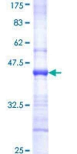 Novus Biologicals Recombinant Human Abhd5 GST (N-Term) Protein 10 &mu;g | Buy Online | Novus Biologicals&trade; | Fisher Scientific