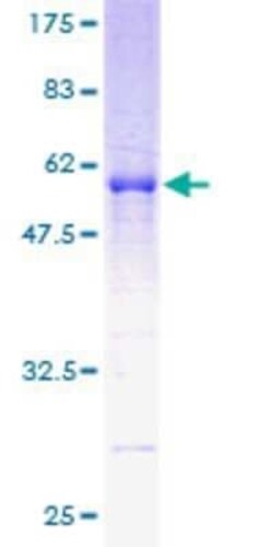 Novus Biologicals Recombinant Human RDH11 GST (N-Term) Protein 10 &mu;g | Buy Online | Novus Biologicals&trade; | Fisher Scientific