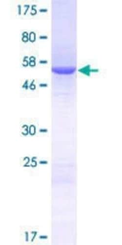 Novus Biologicals Recombinant Human lactamase, beta 2 GST (N-Term) Protein 25 &mu;g | Buy Online | Novus Biologicals&trade; | Fisher Scientific